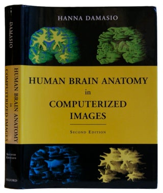 Item #005486786 Human Brain Anatomy in Computerized Images. Hanna Damasio M. D