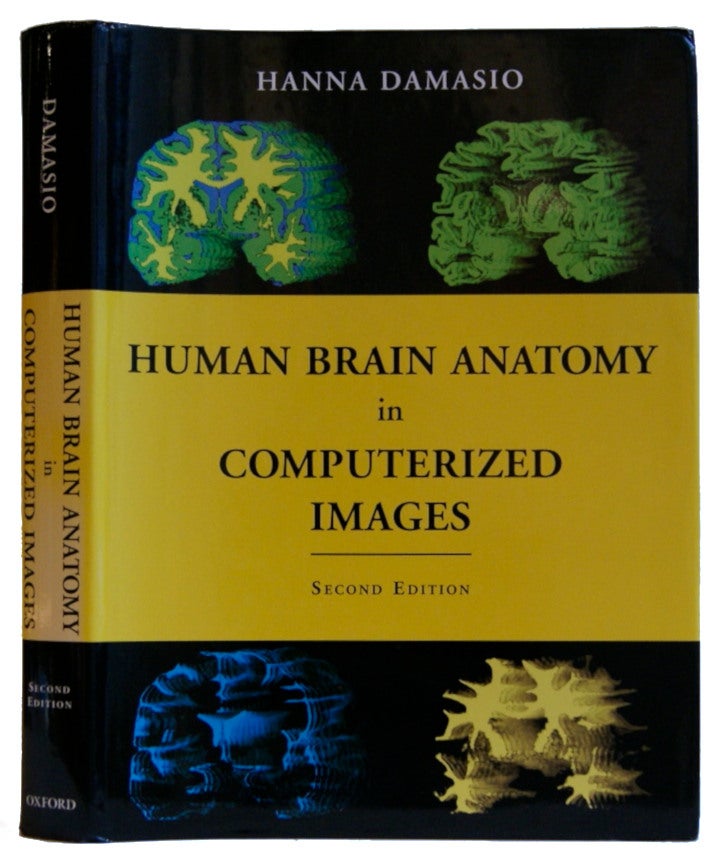 Item #005486786 Human Brain Anatomy in Computerized Images. Hanna Damasio M. D.
